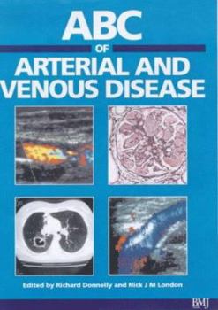 Paperback ABC of Arterial and Venous Disease (ABC Series) Book