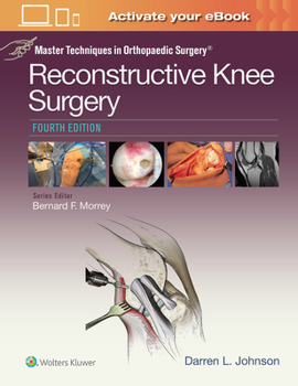 Hardcover Master Techniques in Orthopaedic Surgery: Reconstructive Knee Surgery Book