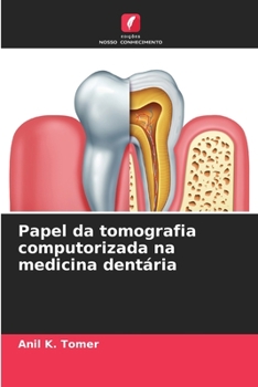 Paperback Papel da tomografia computorizada na medicina dentária [Portuguese] Book