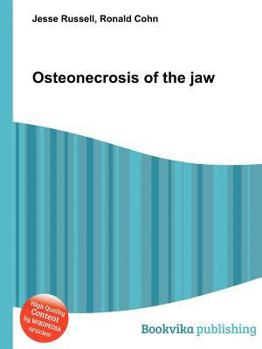 Paperback Osteonecrosis of the Jaw Book