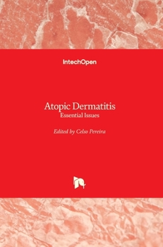 Hardcover Atopic Dermatitis: Essential Issues Book