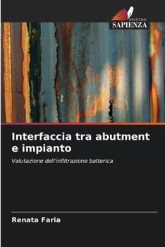 Paperback Interfaccia tra abutment e impianto [Italian] Book