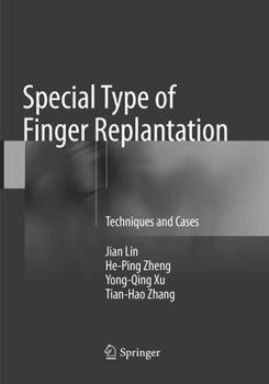 Paperback Special Type of Finger Replantation: Techniques and Cases Book