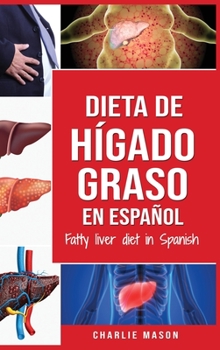 Hardcover Dieta de h?gado graso en espa?ol/Fatty liver diet in Spanish [Spanish] Book