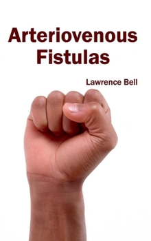 Hardcover Arteriovenous Fistulas Book
