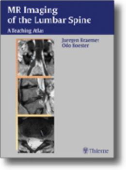 Hardcover Mr-Imaging of the Lumbar Spine: A Teaching Atlas Book
