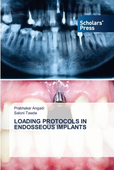 Paperback Loading Protocols in Endosseous Implants Book