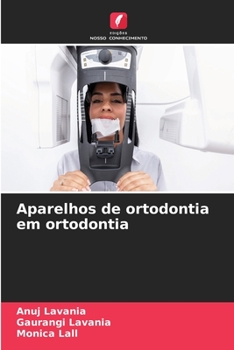 Paperback Aparelhos de ortodontia em ortodontia [Portuguese] Book