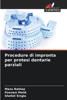 Procedure di impronta per protesi dentarie parziali (Italian Edition)