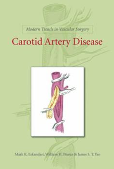 Paperback Modern Trends in Vascular Surgery: Carotid Artery Disease Book