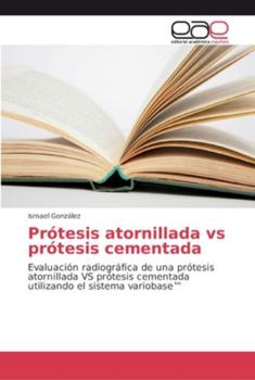 Paperback Prótesis atornillada versus prótesis cementada [Spanish] Book