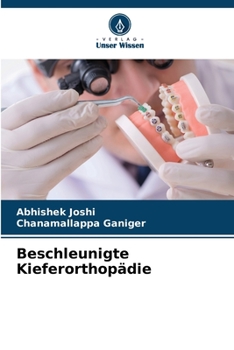 Paperback Beschleunigte Kieferorthopädie [German] Book