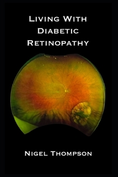 Paperback Living with Diabetic Retinopathy Book