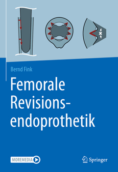 Hardcover Femorale Revisionsendoprothetik [German] Book