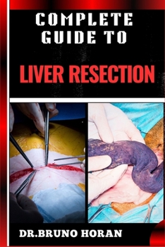 COMPLETE GUIDE TO LIVER RESECTION: Detailed Guide To Hepatic Surgery, Recovery, Post Op Care, Complications, And Diet Management
