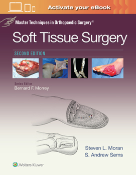 Hardcover Master Techniques in Orthopaedic Surgery: Soft Tissue Surgery Book