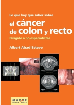 Paperback Lo que hay que saber sobre el cáncer de colon y recto [Spanish] Book