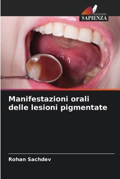 Paperback Manifestazioni orali delle lesioni pigmentate [Italian] Book