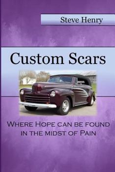 Paperback Custom Scars: Where Hope Can Be Found in the Midst of Pain Book