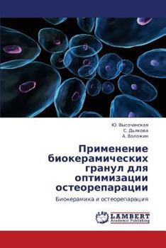 Paperback Primenenie Biokeramicheskikh Granul Dlya Optimizatsii Osteoreparatsii [Russian] Book