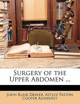 Paperback Surgery of the Upper Abdomen ... Book