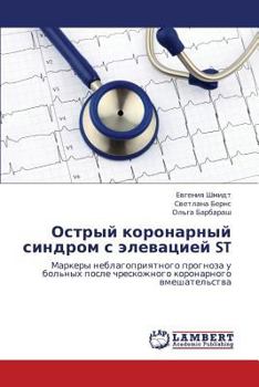 Paperback Ostryy Koronarnyy Sindrom S Elevatsiey St [Russian] Book