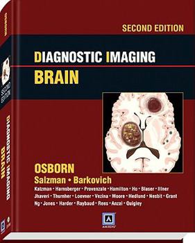 Hardcover Diagnostic Imaging: Brain [With Access Code] Book