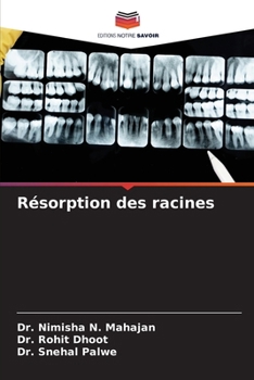 Paperback Résorption des racines [French] Book