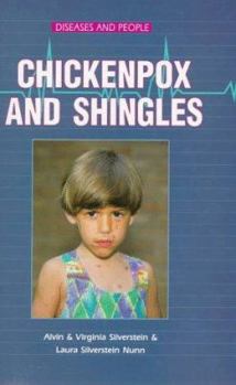 Hardcover Chickenpox and Shingles Book