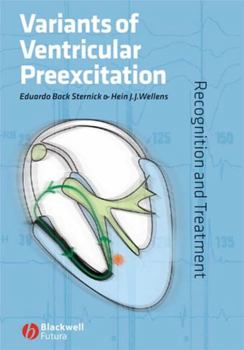 Hardcover Variants of Ventricular Preexcitation: Recognition and Treatment Book