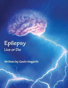 Paperback Epilepsy: Live Or Die Book