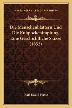 Paperback Die Menschenblattern Und Die Kuhpockenimpfung, Eine Geschichtliche Skizze (1852) [German] Book