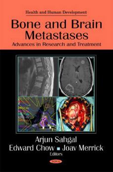 Hardcover Bone and Brain Metastases: Advances in Research and Treatment Book