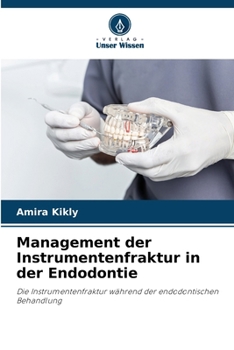 Paperback Management der Instrumentenfraktur in der Endodontie [German] Book