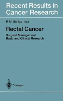Paperback Rectal Cancer: Surgical Management, Basic and Clinical Research Book