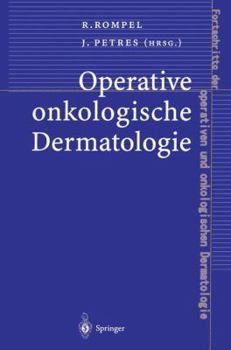 Paperback Operative Onkologische Dermatologie [German] Book
