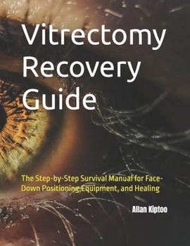Vitrectomy Recovery Guide: The Step-by-Step Survival Manual for Face-Down Positioning,Equipment, and Healing