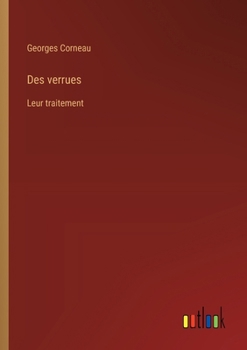 Paperback Des verrues: Leur traitement [French] Book