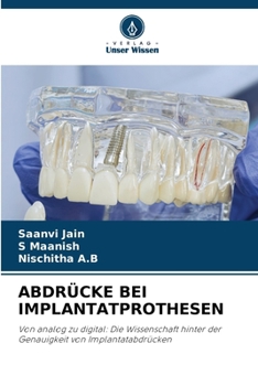 Paperback Abdrücke Bei Implantatprothesen [German] Book
