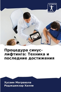Процедура синус-лифтинг&