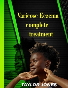 Paperback Varicose eczema Complete treatment: treatment to eczema skin disease Book