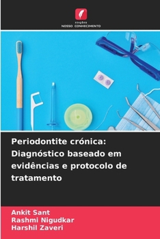 Paperback Periodontite crónica: Diagnóstico baseado em evidências e protocolo de tratamento [Portuguese] Book