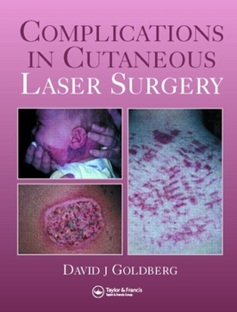 Hardcover Complications in Laser Cutaneous Surgery Book