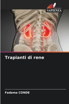 Paperback Trapianti di rene [Italian] Book