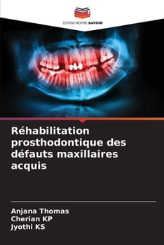 Paperback Réhabilitation prosthodontique des défauts maxillaires acquis [French] Book