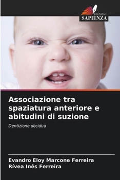 Paperback Associazione tra spaziatura anteriore e abitudini di suzione [Italian] Book