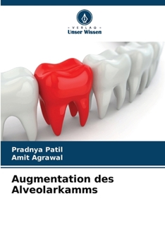 Paperback Augmentation des Alveolarkamms [German] Book