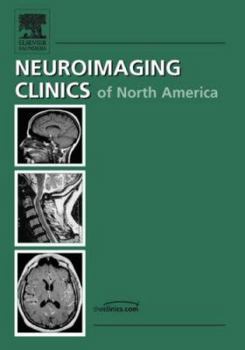 Hardcover Spine Imaging, an Issue of Neuroimaging Clinics: Volume 17-1 Book