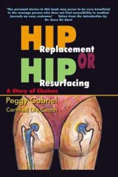 Paperback Hip Replacement or Hip Resurfacing: A Story of Choices Book
