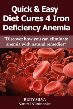 Paperback Anemia: Iron Deficiency Diet: Large Print: Quick and Easy Diet Cures For Anemia [Large Print] Book